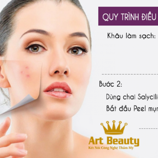 Công nghệ I Peel